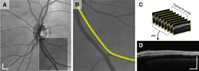 Figure 1 for Depth-resolved vascular profile features for artery-vein classification in OCT and OCT angiography of human retina