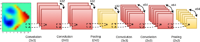 Figure 3 for Learning Robust Features using Deep Learning for Automatic Seizure Detection