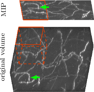 Figure 3 for Tracing in 2D to Reduce the Annotation Effort for 3D Deep Delineation