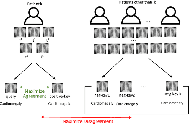 Figure 2 for SCALP -- Supervised Contrastive Learning for Cardiopulmonary Disease Classification and Localization in Chest X-rays using Patient Metadata