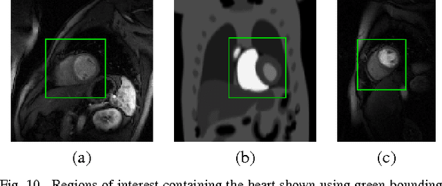 Figure 1 for Low-rank and Adaptive Sparse Signal Models for Highly Accelerated Dynamic Imaging