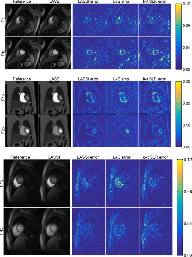 Figure 3 for Low-rank and Adaptive Sparse Signal Models for Highly Accelerated Dynamic Imaging
