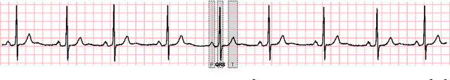 Figure 3 for On the adoption of abductive reasoning for time series interpretation