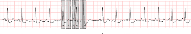 Figure 4 for On the adoption of abductive reasoning for time series interpretation