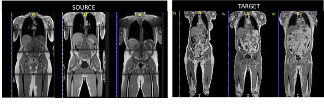 Figure 1 for Domain Adaptation for MRI Organ Segmentation using Reverse Classification Accuracy