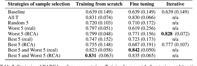 Figure 4 for Domain Adaptation for MRI Organ Segmentation using Reverse Classification Accuracy