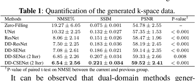 Figure 2 for Dual-Domain Cross-Iteration Squeeze-Excitation Network for Sparse Reconstruction of Brain MRI