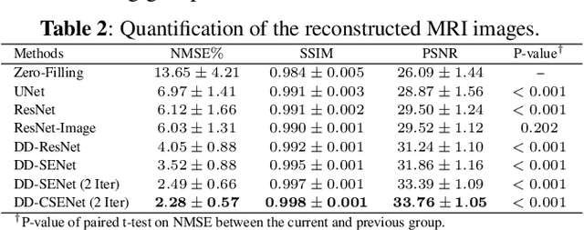 Figure 4 for Dual-Domain Cross-Iteration Squeeze-Excitation Network for Sparse Reconstruction of Brain MRI