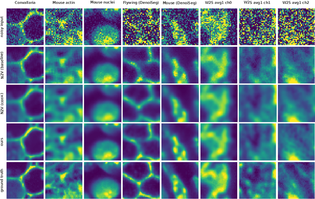 Figure 3 for Improving Blind Spot Denoising for Microscopy