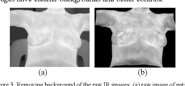 Figure 4 for Segmentation of Infrared Breast Images Using MultiResUnet Neural Network
