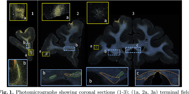 Figure 1 for Constrained self-supervised method with temporal ensembling for fiber bundle detection on anatomic tracing data