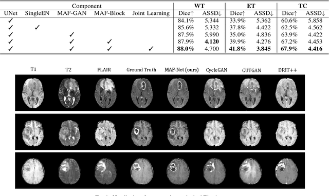 Figure 4 for Multi-modal Brain Tumor Segmentation via Missing Modality Synthesis and Modality-level Attention Fusion