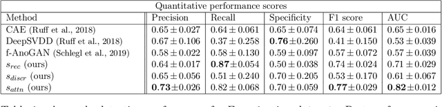 Figure 2 for Learning normal appearance for fetal anomaly screening: Application to the unsupervised detection of Hypoplastic Left Heart Syndrome
