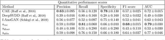 Figure 4 for Learning normal appearance for fetal anomaly screening: Application to the unsupervised detection of Hypoplastic Left Heart Syndrome