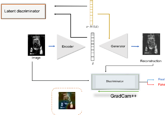 Figure 1 for Learning normal appearance for fetal anomaly screening: Application to the unsupervised detection of Hypoplastic Left Heart Syndrome