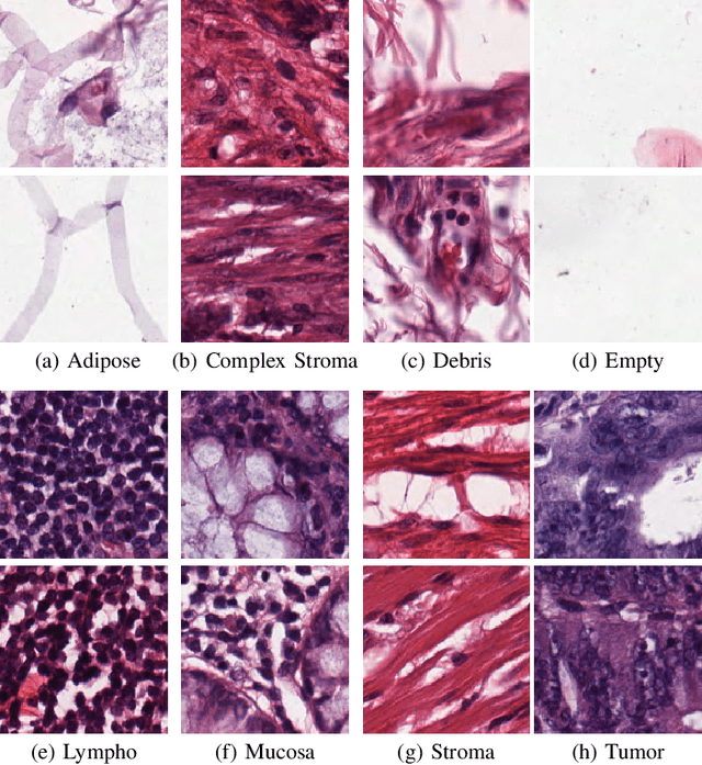 Figure 2 for Double Transfer Learning for Breast Cancer Histopathologic Image Classification
