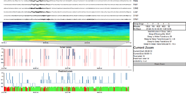 Figure 1 for SLEEPNET: Automated Sleep Staging System via Deep Learning