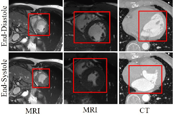 Figure 1 for A Spatiotemporal Volumetric Interpolation Network for 4D Dynamic Medical Image