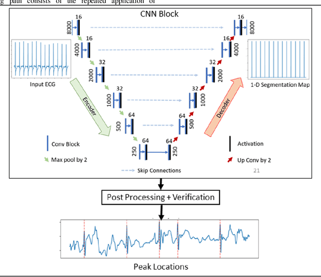 Figure 2 for Robust R-Peak Detection in Low-Quality Holter ECGs using 1D Convolutional Neural Network