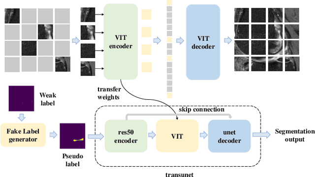 Figure 1 for Automatic segmentation of meniscus based on MAE self-supervision and point-line weak supervision paradigm
