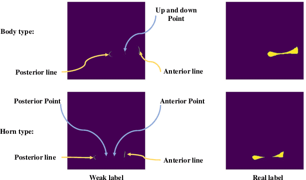 Figure 4 for Automatic segmentation of meniscus based on MAE self-supervision and point-line weak supervision paradigm