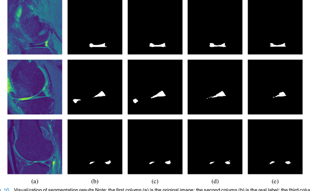 Figure 2 for Automatic segmentation of meniscus based on MAE self-supervision and point-line weak supervision paradigm