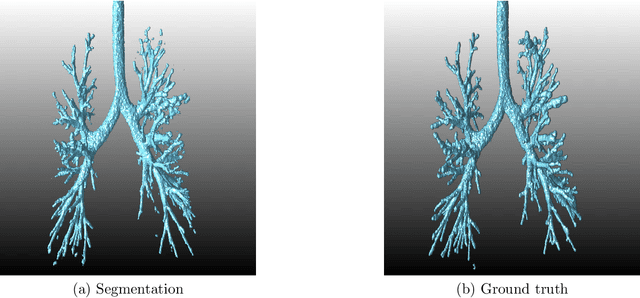 Figure 3 for Automated airway segmentation by learning graphical structure