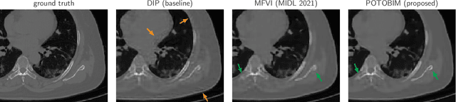 Figure 1 for Posterior temperature optimized Bayesian models for inverse problems in medical imaging