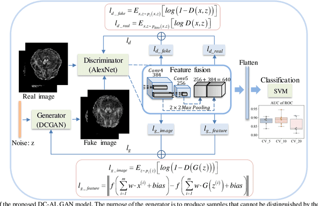Figure 1 for DC-Al GAN: Pseudoprogression and True Tumor Progression of Glioblastoma multiform Image Classification Based On DCGAN and Alexnet