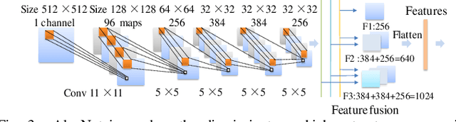 Figure 4 for DC-Al GAN: Pseudoprogression and True Tumor Progression of Glioblastoma multiform Image Classification Based On DCGAN and Alexnet