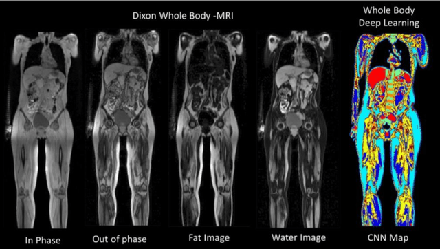 Figure 1 for Multiparametric Deep Learning Tissue Signatures for Muscular Dystrophy: Preliminary Results