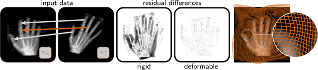 Figure 1 for PDE-constrained optimization in medical image analysis