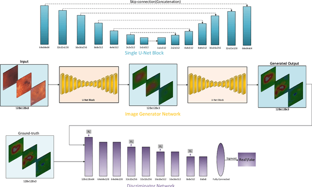 Figure 2 for Heightmap Reconstruction of Macula on Color Fundus Images Using Conditional Generative Adversarial Networks