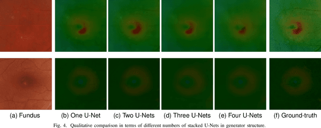 Figure 4 for Heightmap Reconstruction of Macula on Color Fundus Images Using Conditional Generative Adversarial Networks