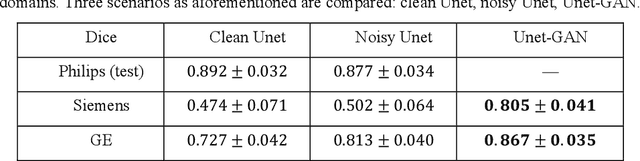 Figure 2 for The Domain Shift Problem of Medical Image Segmentation and Vendor-Adaptation by Unet-GAN
