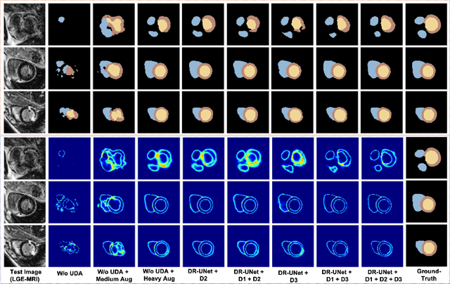 Figure 4 for Adapt Everywhere: Unsupervised Adaptation of Point-Clouds and Entropy Minimisation for Multi-modal Cardiac Image Segmentation