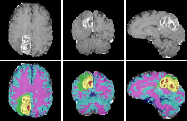 Figure 3 for A Novel Domain Adaptation Framework for Medical Image Segmentation