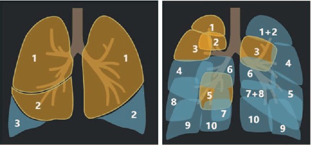Figure 2 for Joint Prediction and Time Estimation of COVID-19 Developing Severe Symptoms using Chest CT Scan