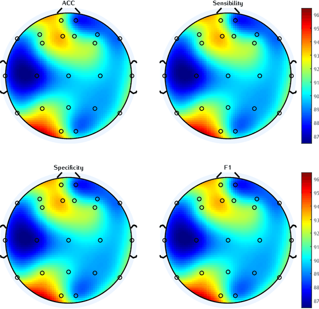 Figure 4 for Mental arithmetic task classification with convolutional neural network based on spectral-temporal features from EEG