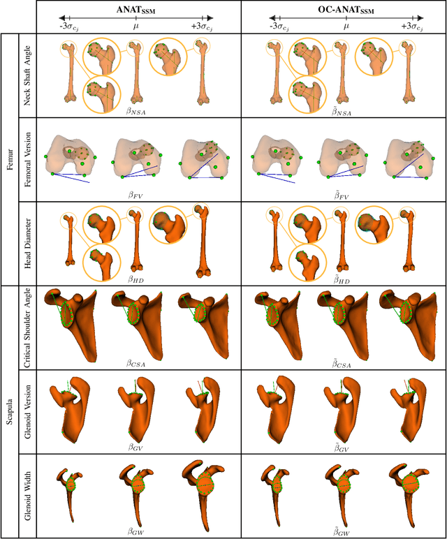 Figure 4 for Anatomically Parameterized Statistical Shape Model: Explaining Morphometry through Statistical Learning