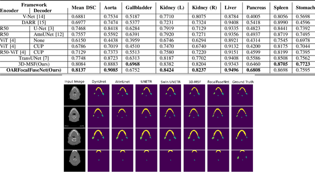 Figure 2 for An Efficient Multi-Scale Fusion Network for 3D Organ at Risk Segmentation