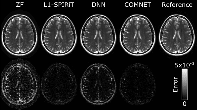 Figure 4 for A Few-Shot Learning Approach for Accelerated MRI via Fusion of Data-Driven and Subject-Driven Priors