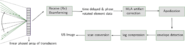 Figure 3 for High frame-rate cardiac ultrasound imaging with deep learning