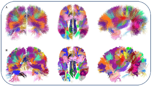 Figure 1 for Parallel optimization of fiber bundle segmentation for massive tractography datasets