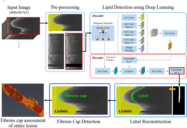 Figure 1 for Automated analysis of fibrous cap in intravascular optical coherence tomography images of coronary arteries