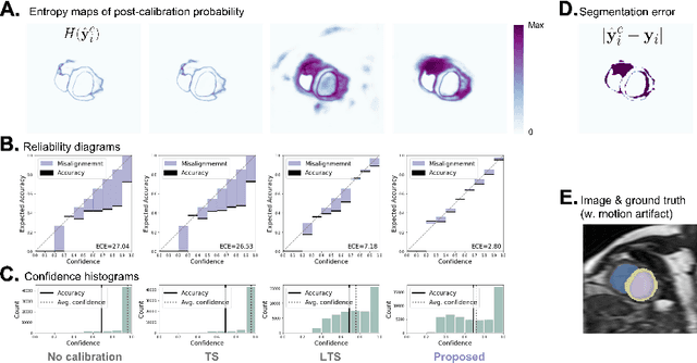 Figure 4 for Improved post-hoc probability calibration for out-of-domain MRI segmentation