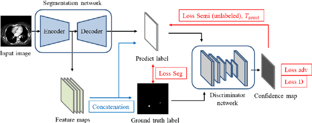 Figure 3 for Feature-enhanced Adversarial Semi-supervised Semantic Segmentation Network for Pulmonary Embolism Annotation