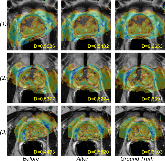Figure 2 for Adversarial Image Registration with Application for MR and TRUS Image Fusion