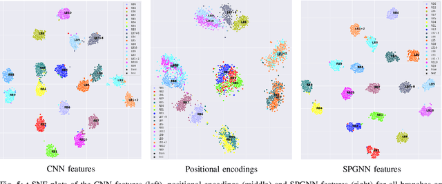 Figure 2 for Structure and position-aware graph neural network for airway labeling