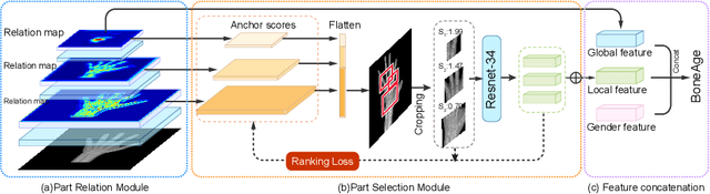 Figure 1 for PRSNet: Part Relation and Selection Network for Bone Age Assessment